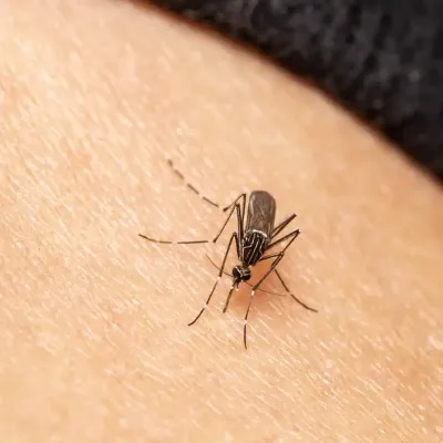 mosquito-on-hand